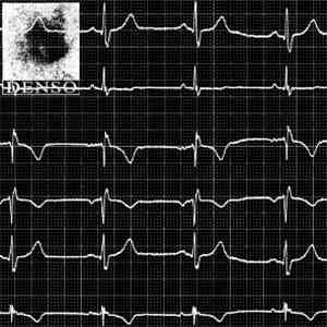 DENSO - 071113 / Aritmie download free